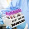 Lab testing