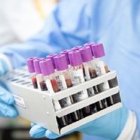 Lab testing
